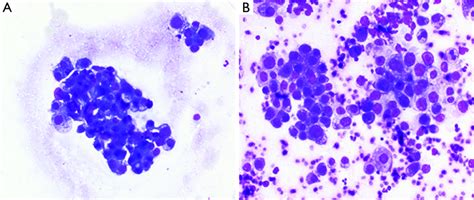 Modified Giemsa stain - 500ML size Giemsa Solution - MilliporeSigma - muktibox.com