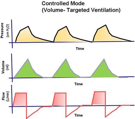 MODOVI MEHANIČKE VENTILACIJE MECHANICAL VENTILATION MODES