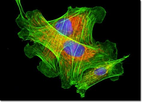 Molecular Expressions Microscopy Primer: Specialized Microscopy ... - wintechmobiles.com
