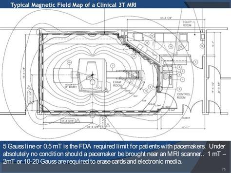 MRI PHYSICS PART 2 | MRI Magnet System | Superconducting Magnet ... - wintechmobiles.com