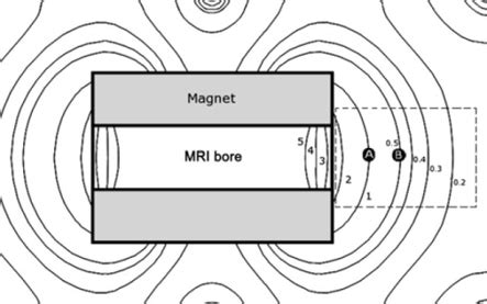 Mri Scan Magnetic Field - wintechmobiles.com