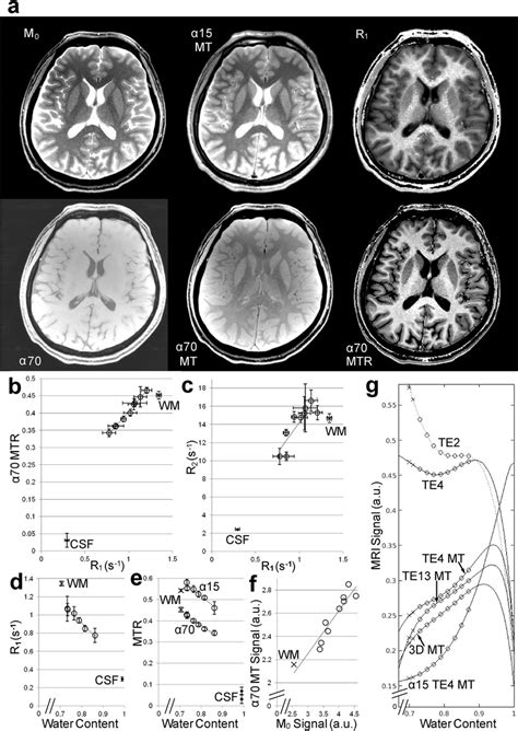 MRI T1 Mapping: Understanding Magnetization Transfer Sensitivity (2026)