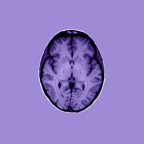 MRI image formation - e-MRI - IMAIOS