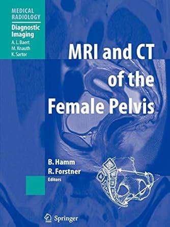 Read Online Mri And Ct Of The Female Pelvis Medical Radiology By Rosemarie Forstner