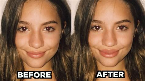 Mackenzie Ziegler’s before and after phot