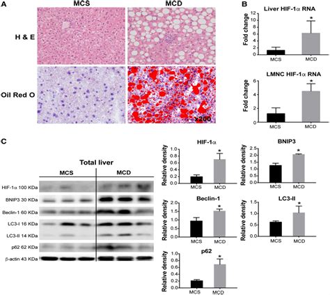 Macrophage-Specific Hypoxia-Inducible Factor-1α …