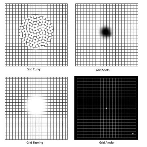 Macular Degeneration Grid Check Your Vision with an Amsler Grid