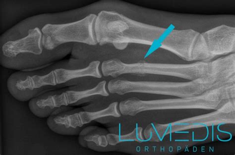 Madison Kallus Leaked [HD] 🍑 195 Pics