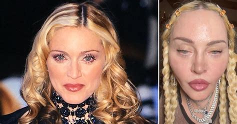 After clapping back at haters following a slew of plastic surgery rumors, Madonna was actually deeply “affected” by the comments made by naysayers and is looking to switch up her look again .... 