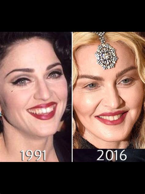 What did Madonna do to her face? Her before and after photo, explained. The consensus among her fans appears to be "what happened?" Cody Raschella.. 