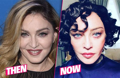 Madonna Plastic Surgery. Two weeks after admirers expressed