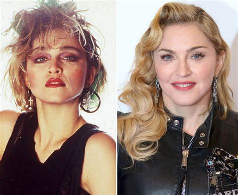 Madonna posted an up-close selfie of her new look on Instagram before Sunday’s Grammys. 7 During the Grammys, viewers took to social media to question the 64-year-old singer’s puffy face and lips.. 