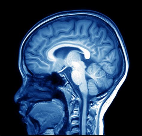 Magnetic Resonance Imaging MRI Brain Scan with Contrast Dye