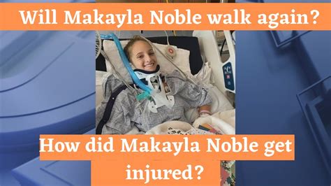 Makayla noble what happened. Makayla Noble, a high school cheerleader from Texas, has spoken about the moment she was paralzyed in a freak accident. The 17-year-old from Prosper, Texas, severely injured her spinal cord... 