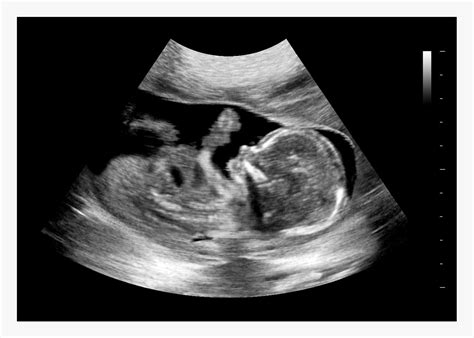 Prank Anyone - These fake ultrasound phot