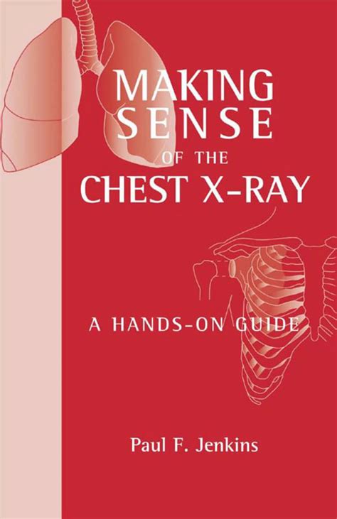 Making sense of the chest x ray a hands on guide hodder arnold publication. - Westland sea king in detail photo manual for modelers.