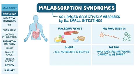 Malabsorption Syndromes - Science topic - ResearchGate