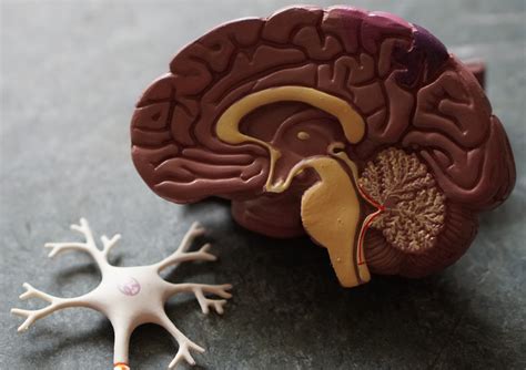 Malattie neurodegenerative: cosa sono, sintomi, cure e …