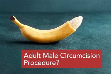 Male Adult Circumcision; Erişkin Erkek Sünneti YouTube. 