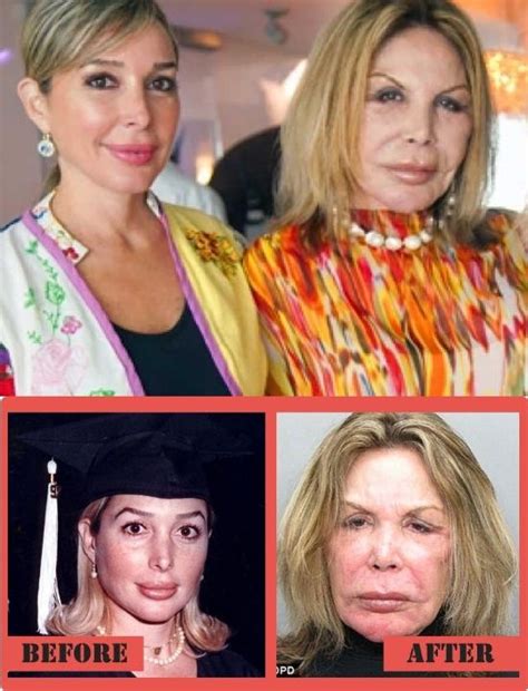 Mama elsa before surgery. Oct 1, 2013 · Marysol Patton's beloved mother, Elsa, makes her long-awaited return to The Real Housewives Of Miami on Monday night, following her near-death accident and subsequent brain surgery. Close bond ... 