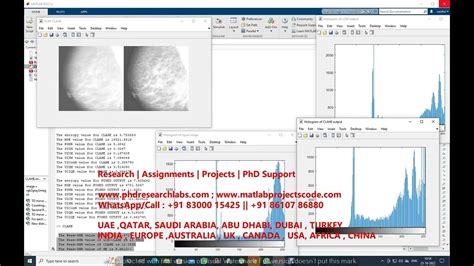 Mammography Matlab Code