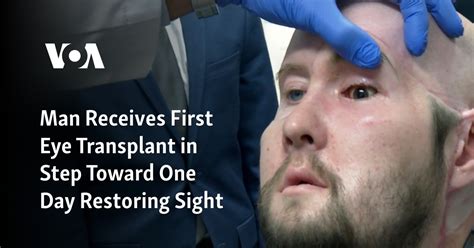 Man receives the first eye transplant plus a new face. It’s a step toward one day restoring sight