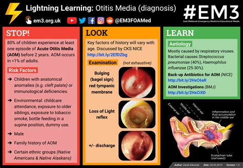 Management Otitis media with effusion CKS - NICE