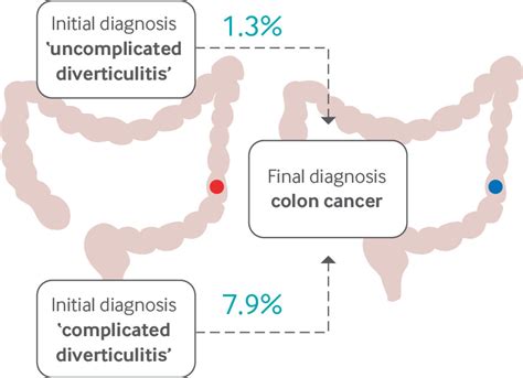 Management of Colonic Diverticulitis Effective …