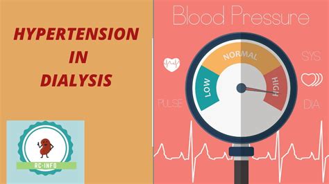 Management of hypertension in hemodialysis patients