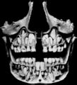 Mandibular köpek dişi Vikipedi.