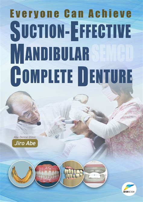 Mandibular suction effective denture and bps a complete guide. - Winchester 22 lr model 190 cleaning manual.