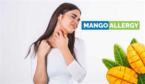 Mango-Associated Dermatitis: What are the Treatment Options?