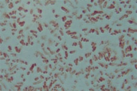 Mannheimia haemolytica pronunciation. .  <a href=https://mb.maxgroup.al/assets/images/8i...