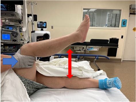 Manual Manipulation After Total Knee Replacement