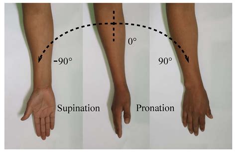 Manual Muscle Testing of the Forearm Supination and Pronation