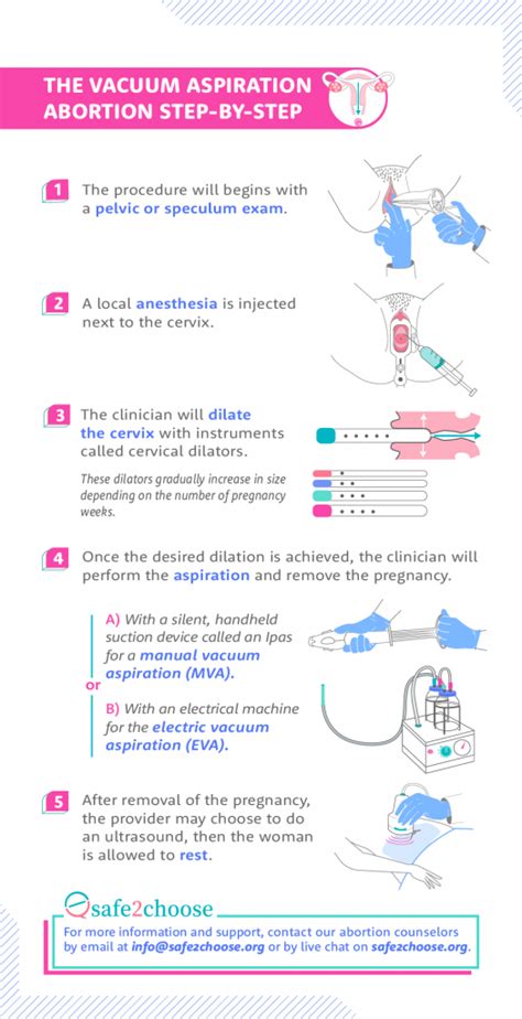 Manual Vacuum Aspiration Procedure Note