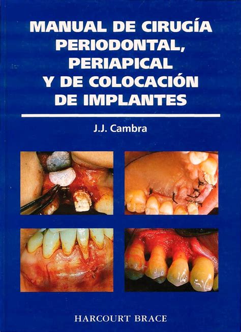 Manual de cirugia periodontal periapical y de colocacion de implantes 1e spanish edition. - Honda cbr250 japanese workshop service repair manual 1987 1991 cbr 250.
