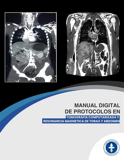 Manual de servicio de tomografía computarizada médica. - Mercury 75hp 3 cyl 2 stroke manual.