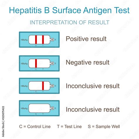 Manual for hepatitis b antigen testing. - Polaris snowmobile 2007 2011 iq rmk switchback repair manual.