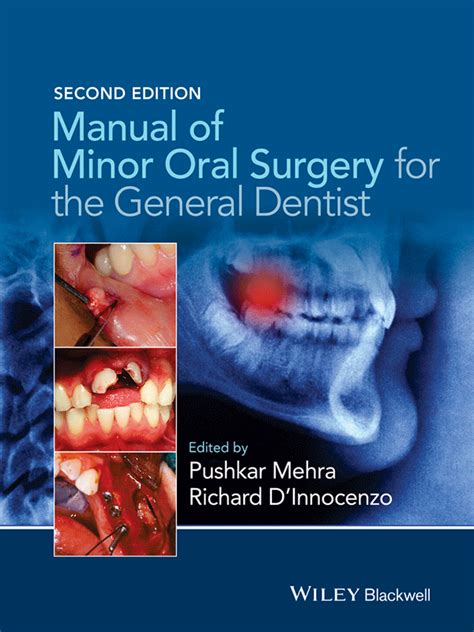 Manual of Minor Oral Surgery for the General Dentist - FLIP …