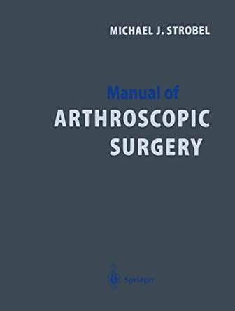 Manual of arthroscopic surgery by michael j strobel. - Mercedes benz sl klasse r129 autowerkstatt reparaturanleitung.