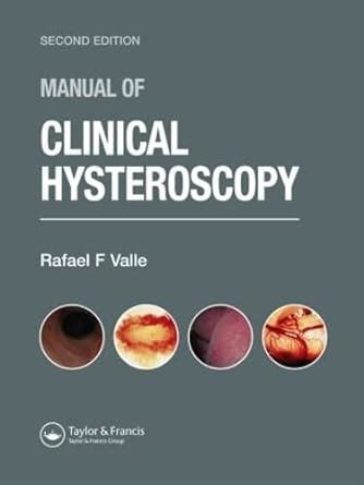 Manual of clinical hysteroscopy second edition. - York 925 home gym instruction manual.