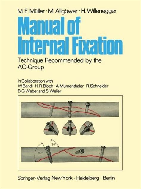 Manual of internal fixation technique recommended by the ao group swiss association for the study of internal fixation asif. - The guide to the jewish internet.