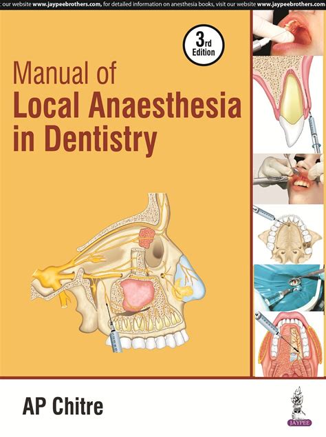 Manual of local anaesthesia in dentistry by ap chitre. - Una piedra extraordinaria (coleccion primeras lecturas).