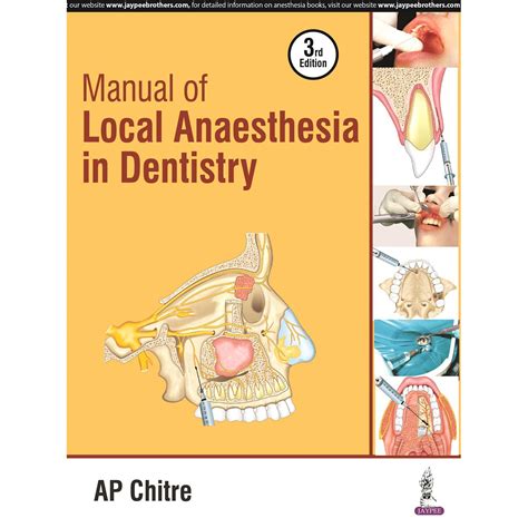Manual of local anaesthesia in dentistry. - 1977 johnson 70 hp outboard wiring manual.