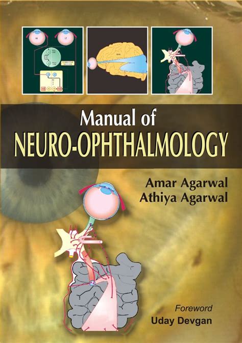 Manual of neuro ophthalmology by amar agarwal. - Pos guide for passport cash register.