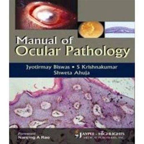 Manual of ocular pathology 2010 1st edition. - Professional asp net 2 0 databases wrox professional guides.