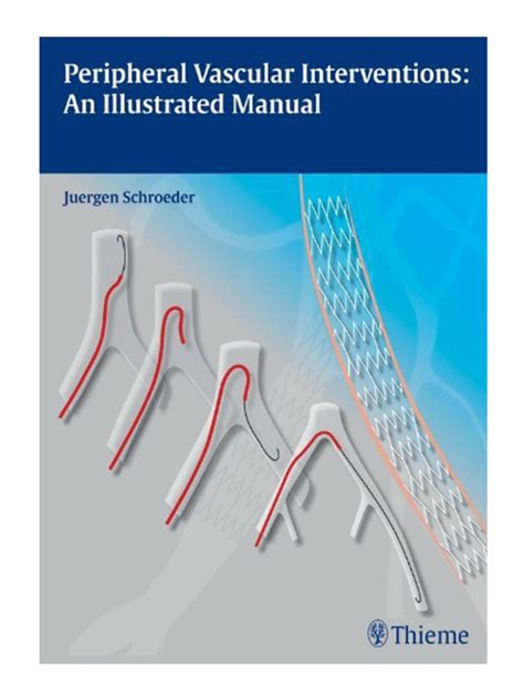 Manual of peripheral vascular intervention manual of peripheral vascular intervention. - Man sv service manual 6 tonne truck.