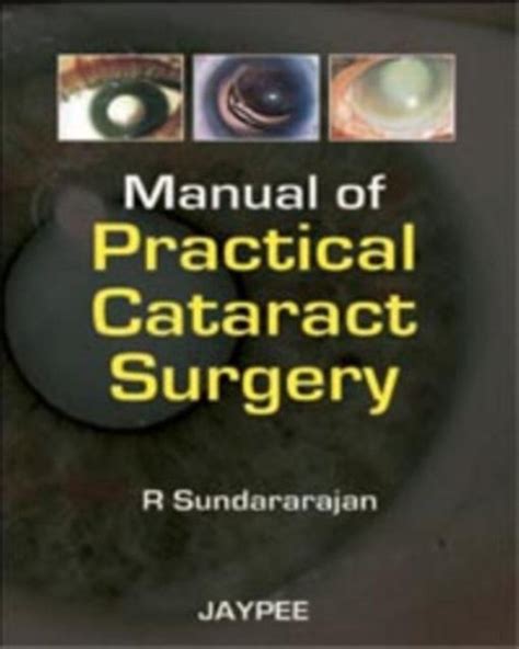 Manual of practical cataract surgery by r sundarajan. - System powiązań między rolnictwem, rynkem i przetwórstwen.