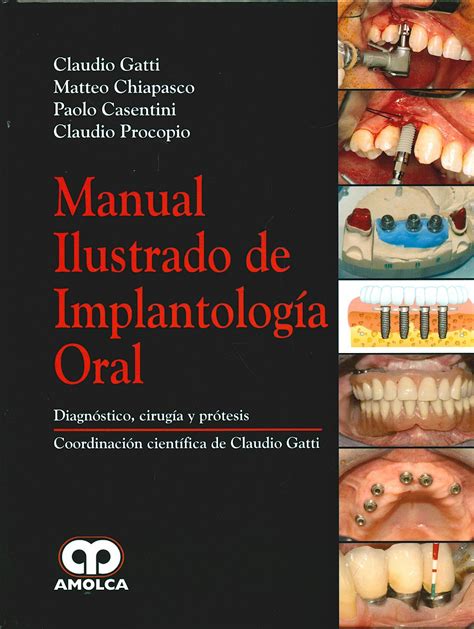 Manual quirúrgico de implantología dental descargar gratis o leer. - How to change from automatic to manual licence nsw.
